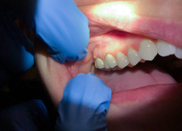 Best Emergency Dental Care for Trauma or Injury in Malvern, PA
